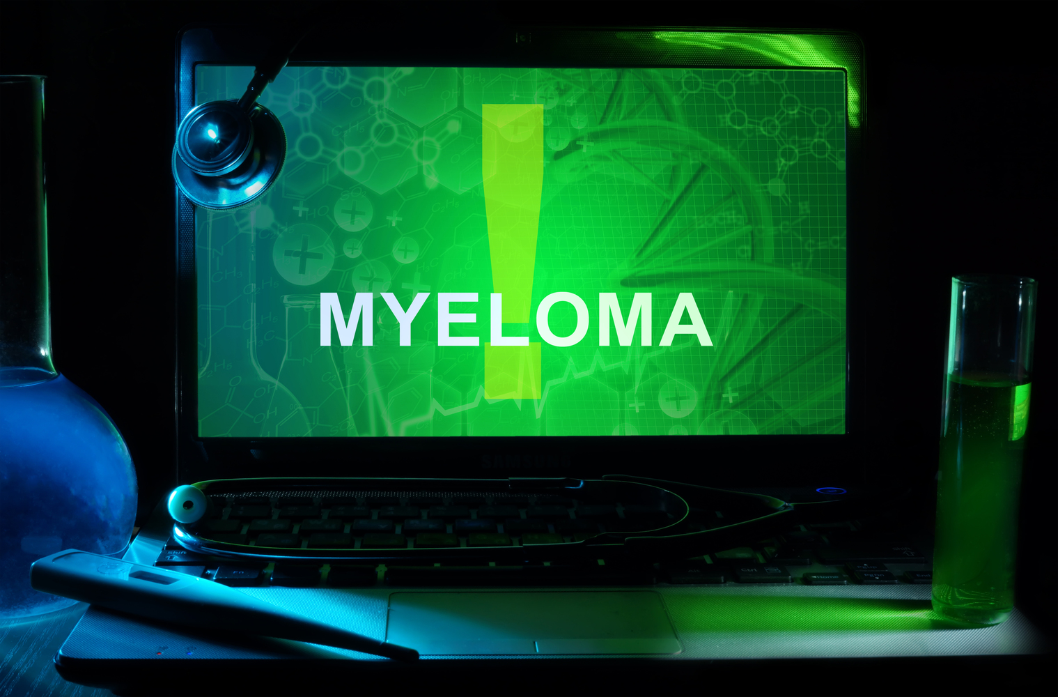 Multiple myeloma and its complications