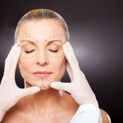 Things to Consider Before Getting Cosmetic Surgery